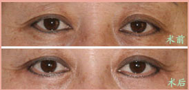 �˽��۴������������ȫ