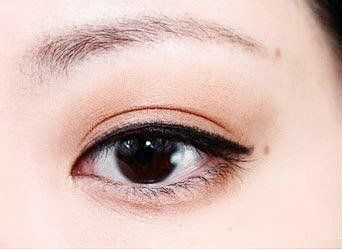 ���۾������ĺ�ɫ����