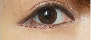 �������߻���