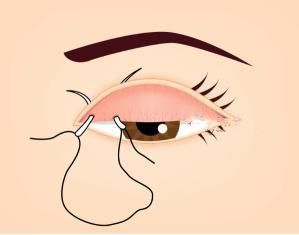 �����ߴ�����Ĥ��Ƥ��