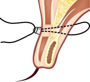 �۲��������ͼ