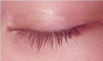 �����˫��Ƥ��