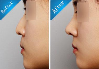 һ�����������ļ�ǿ ʱ��������Ŀ����ʱЧ