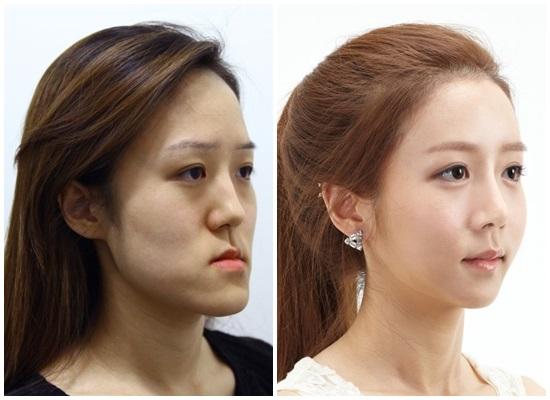 һ�����������ļ�ǿ ʱ��������Ŀ����ʱЧ