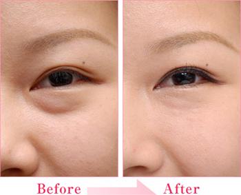 һ�����������ļ�ǿ ʱ��������Ŀ����ʱЧ