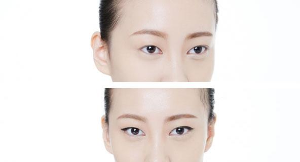 ֻ���������� ���㡰�۽�󿪡�