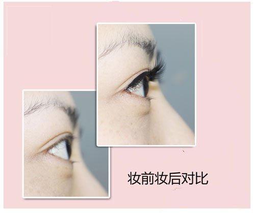 ��С�۲�Ӭ�� Ů���ëױ��Ҳ���BUG