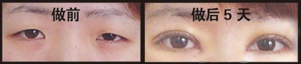 ���������г� ����˫��Ƥ���쳣