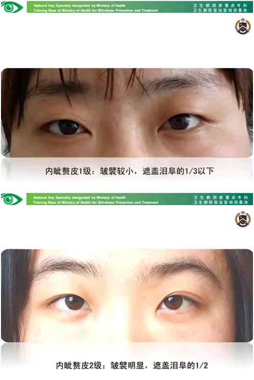 �����ҽ��á����п�����������������������׸Ƥ�ļ���