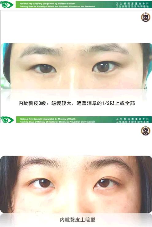 �����ҽ��á����п�����������������������׸Ƥ�ļ���