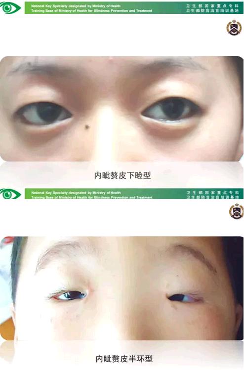 �����ҽ��á����п�����������������������׸Ƥ�ļ���