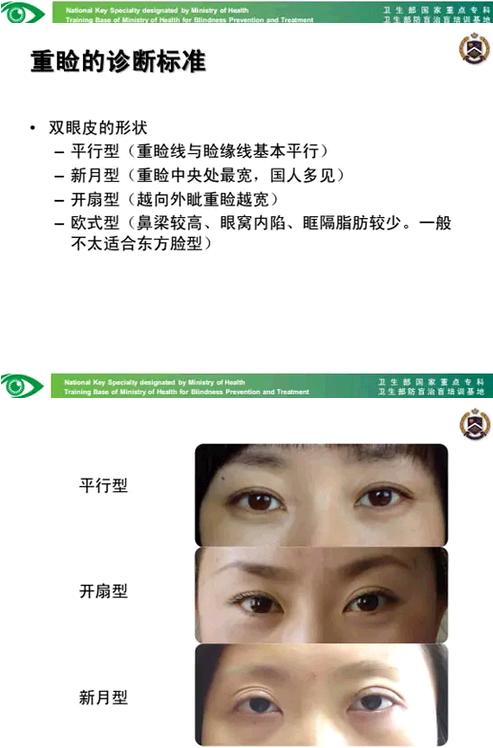 �����ҽ��á����п�����������������������׸Ƥ�ļ���