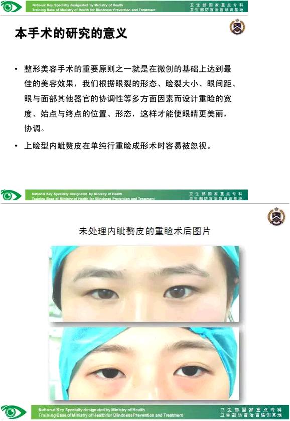 �����ҽ��á����п�����������������������׸Ƥ�ļ���