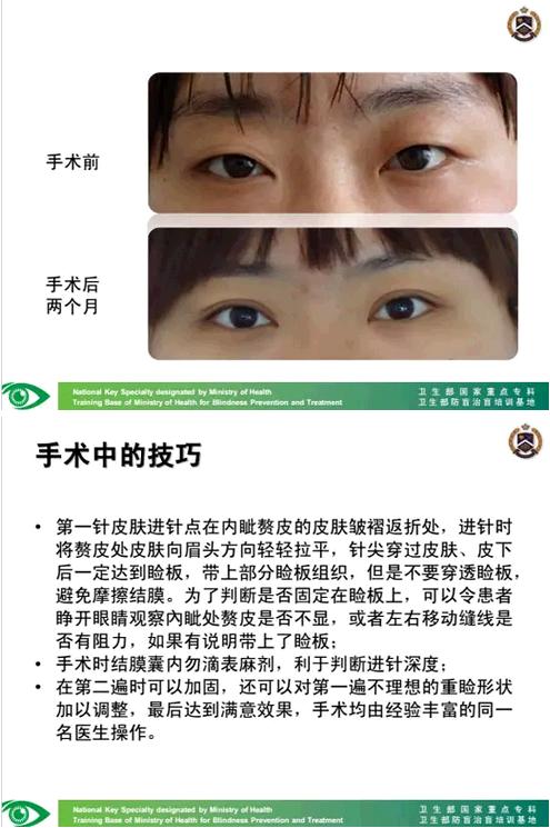 �����ҽ��á����п�����������������������׸Ƥ�ļ���