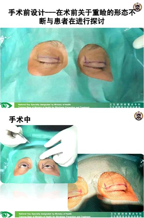 �����ҽ��á����п�����������������������׸Ƥ�ļ���