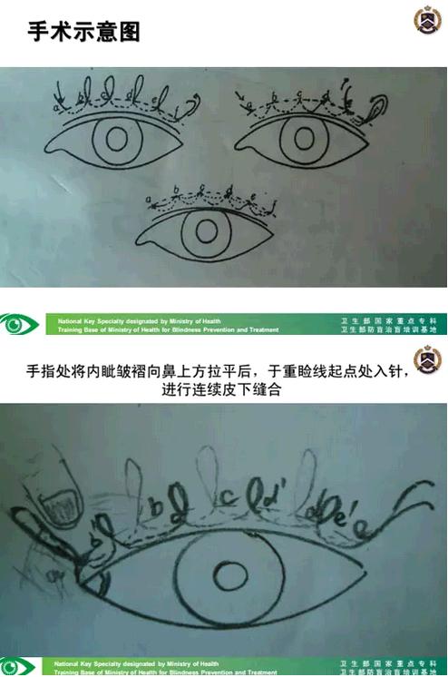 �����ҽ��á����п�����������������������׸Ƥ�ļ���