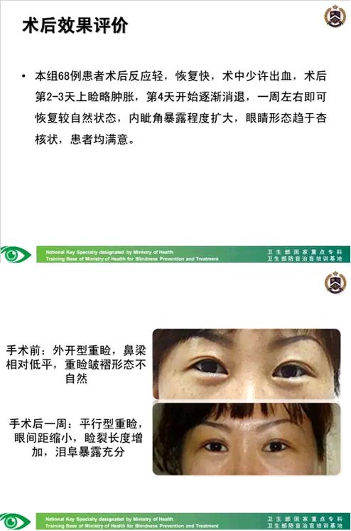 �����ҽ��á����п�����������������������׸Ƥ�ļ���