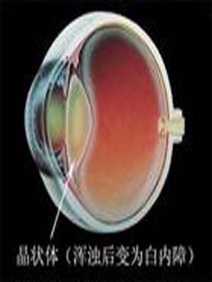 �շ������ϵİ���ԭ��