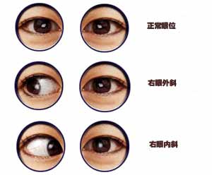 ר��̸б�ӡ����Ƶ�Σ��