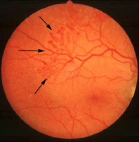 ��������������Ĥ���� 