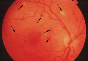 ��������Ĥ���������