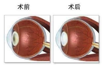 ��������������0.3-0.4��������