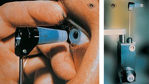 Goldmann��ѹ��