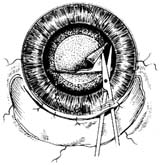 �Ҵ����˹�����ֲ������