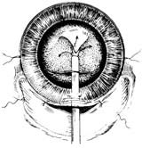 �Ҵ����˹�����ֲ������