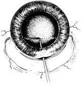 �Ҵ����˹�����ֲ������