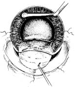 �Ҵ����˹�����ֲ������