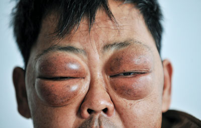 һ����˫���������� ҽ����Сʱȷ�� 