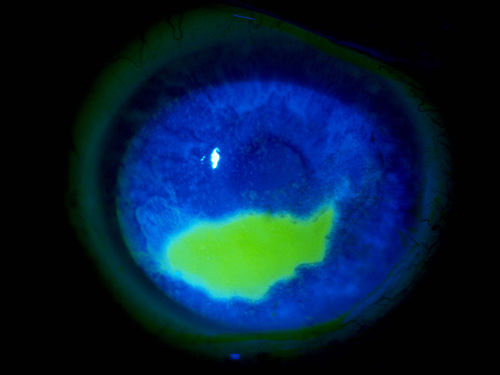 1.��Ĥ����