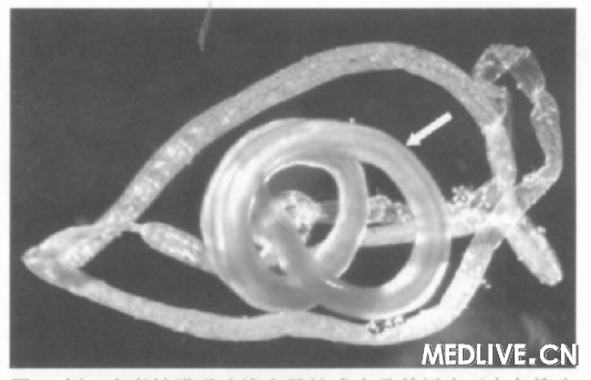 ͼ2��2���߽�Ĥ��˱����Գɳ漰����Ƥ����ɫ��ͷʾ���壩������΢���´������ࡣ