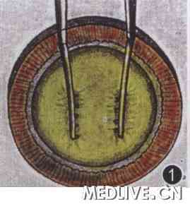 �µ��գ��ع˱���̨������Ϻ����������ķ�չ  ͼ1�а���������ժ����ʱ���õľ�״��ǰ��Ĥ�п�����ʾ��ͼ  