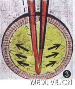 �µ��գ��ع˱���̨������Ϻ����������ķ�չ  ͼ3�а���������ժ����ʾ�⣬�ɼ�����ת����״�壬˺�Ͼ�״�����ʹ�