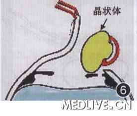 �µ��գ��ع˱���̨������Ϻ����������ķ�չ  ͼ6  �Է�������ʽ����״��ժ��ʾ��ͼ