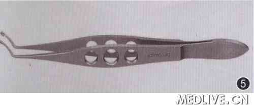 �µ��գ��ع˱���̨������Ϻ����������ķ�չ  ͼ5 Arruga��״����Ĥ�����ͼ