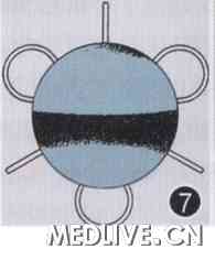 �µ��գ��ع˱���̨������Ϻ����������ķ�չ  ͼ7  ��������(Fyodoro�ġ�Sputnik����Ĥ�����˹���״��ʾ��ͼ