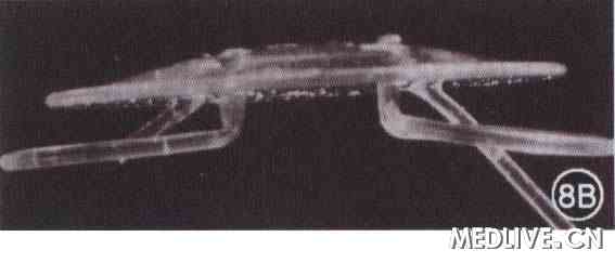 �µ��գ��ع˱���̨������Ϻ����������ķ�չ  ͼ8B Worst Medallion��Ĥ�����˹���״������