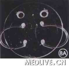 �µ��գ��ع˱���̨������Ϻ����������ķ�չ  ͼ8A Worst Medallion��Ĥ�����˹���״�������