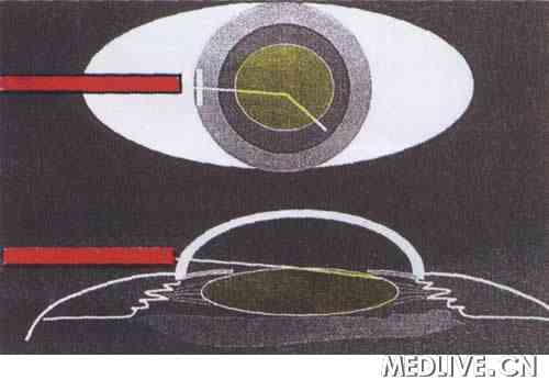 �µ��գ��ع˱���̨������Ϻ����������ķ�չ  ͼ11  ����������ժ������ˮ���뷽��ʾ��ͼ