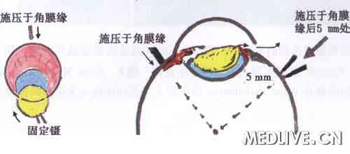 �µ��գ��ع˱���̨������Ϻ����������ķ�չ  ͼ12����������ժ�����������״���ʾ��ͼ