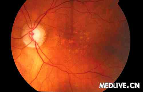 AMD FFaͼ �·�������ģ�Ϳ�Ԥ��AMD��չ 