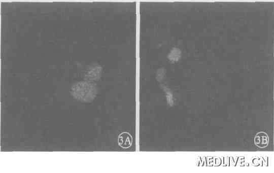 ͼ3��˫��FFA ��(3A ���ۣ� 3B ����) ����������ĤѪ��Ӱ��ǰ��  ���̱ǲ��Ե¡�����������ԵĿ������Է�ӫ��