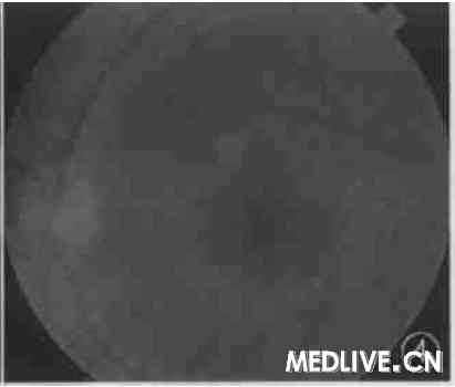 ͼ4  �����۵�����ͬͼ3