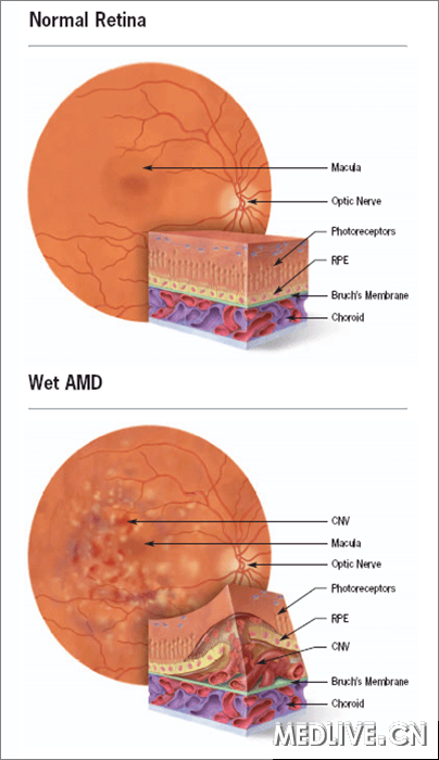 ��������Ĥ��ʪ��AMD������Ĥͼ