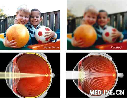 ��������Ұ����������ϻ�����Ұ���ң���ҽ��ͨ��ͼ��