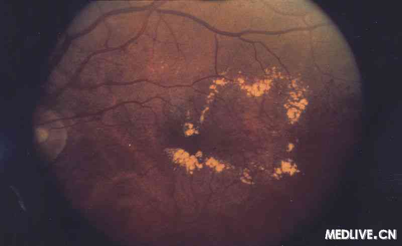 �����Իư�ˮ��FFaͼ��ҽ��ͨ��ͼ��