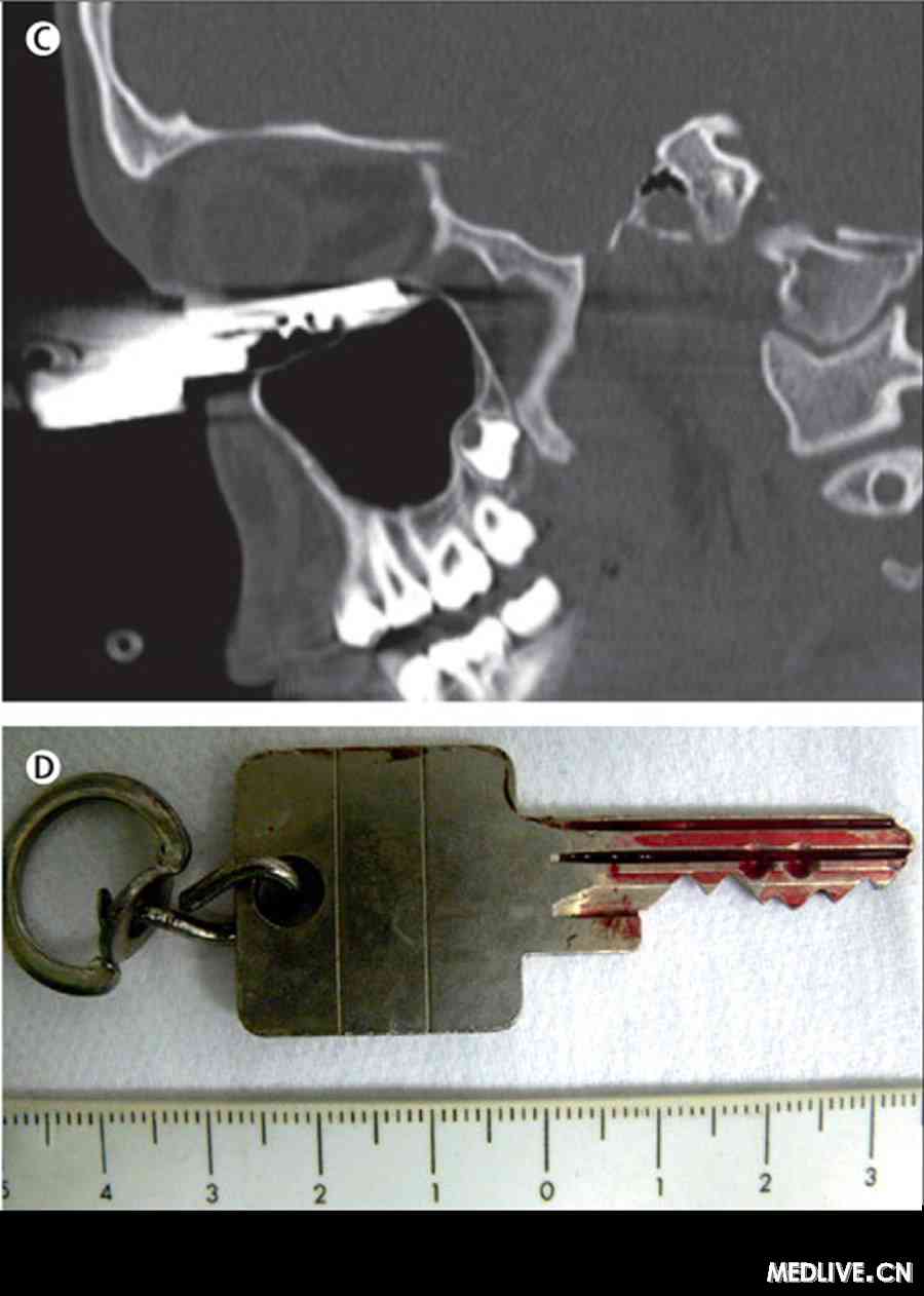 ͼC������������λ��Կ�״����ۿ��±ڡ��ۼ������񾭼�����δ���� ͼD�����������λΪcm 